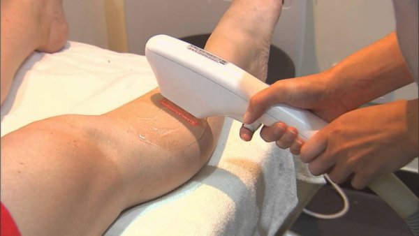 Виды лазеров для лазерной эпиляции