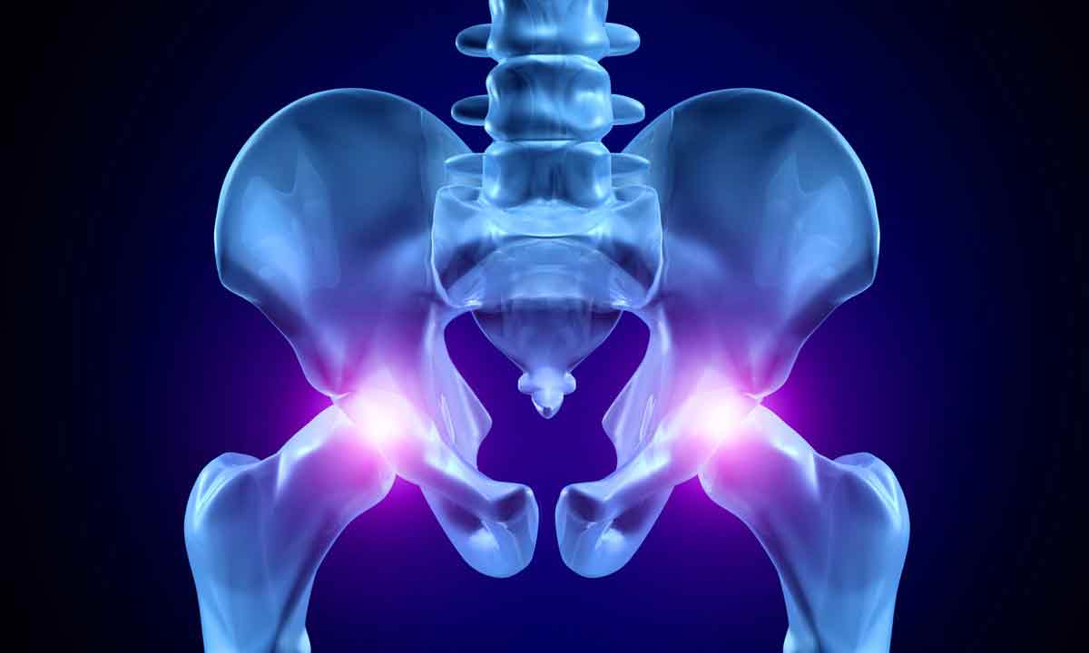 Тазобедренный сустав – реабилитация