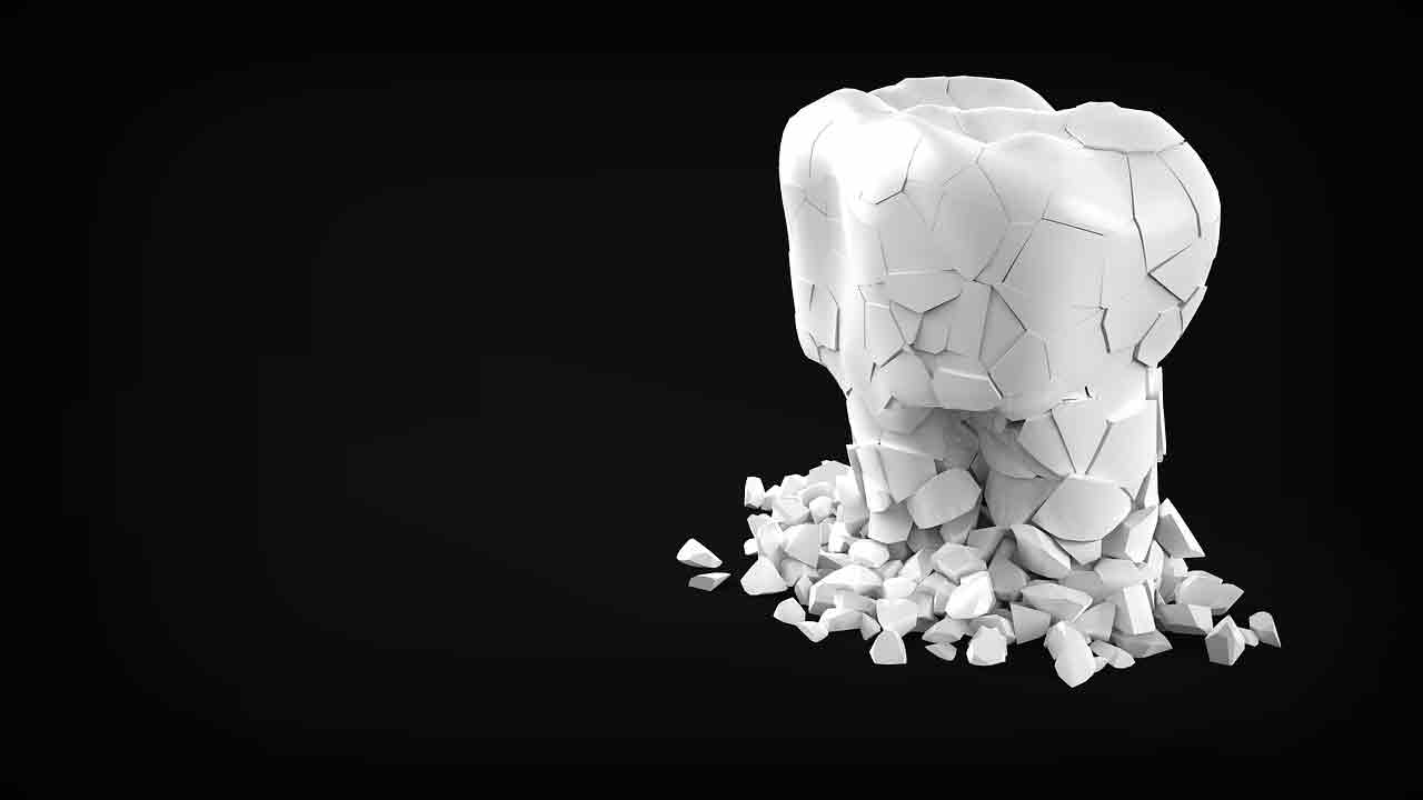 Эндодонтия - лечение корневых каналов