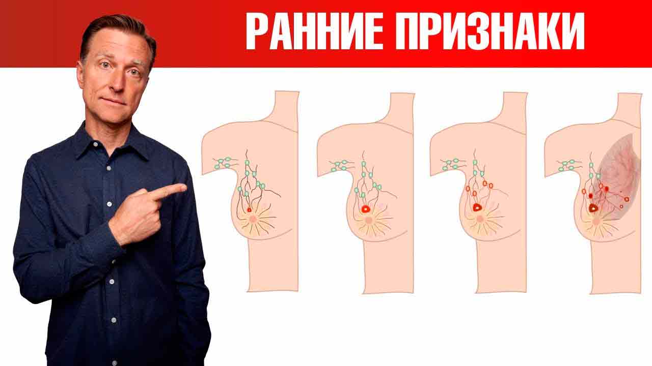 Такая грудь увеличивает риск рака в 4 раза