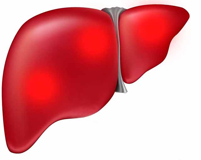 Изменения в образе жизни, чтобы сохранить здоровье печени